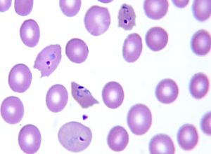 Late trophozoite plasmodium ovale