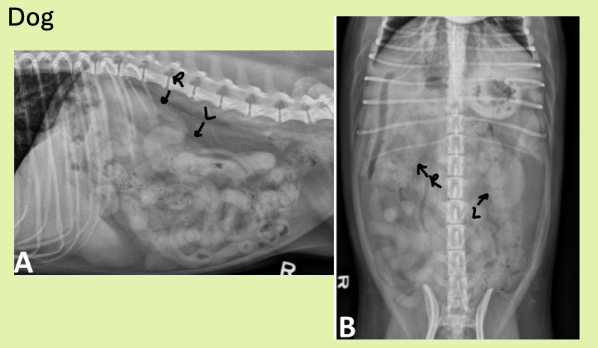 <p>R kidney - 13th rib where cr. pole touches caudate lobe of liver</p><p>L kidney - more cd. than right kidney. Just behind gastric fundus, cd/med to splenic head</p>