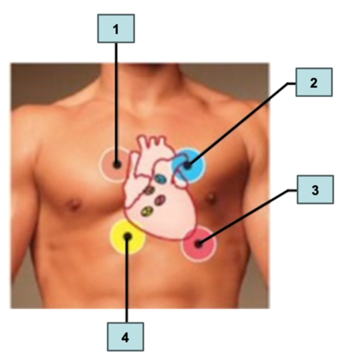 <p>Label the four areas for auscultating heart sounds.</p><p>a. Pulmonary SL valve</p><p>b. Mitral AV valve</p><p>c. Aortic SL valve</p><p>d. Tricuspid AV valve </p>
