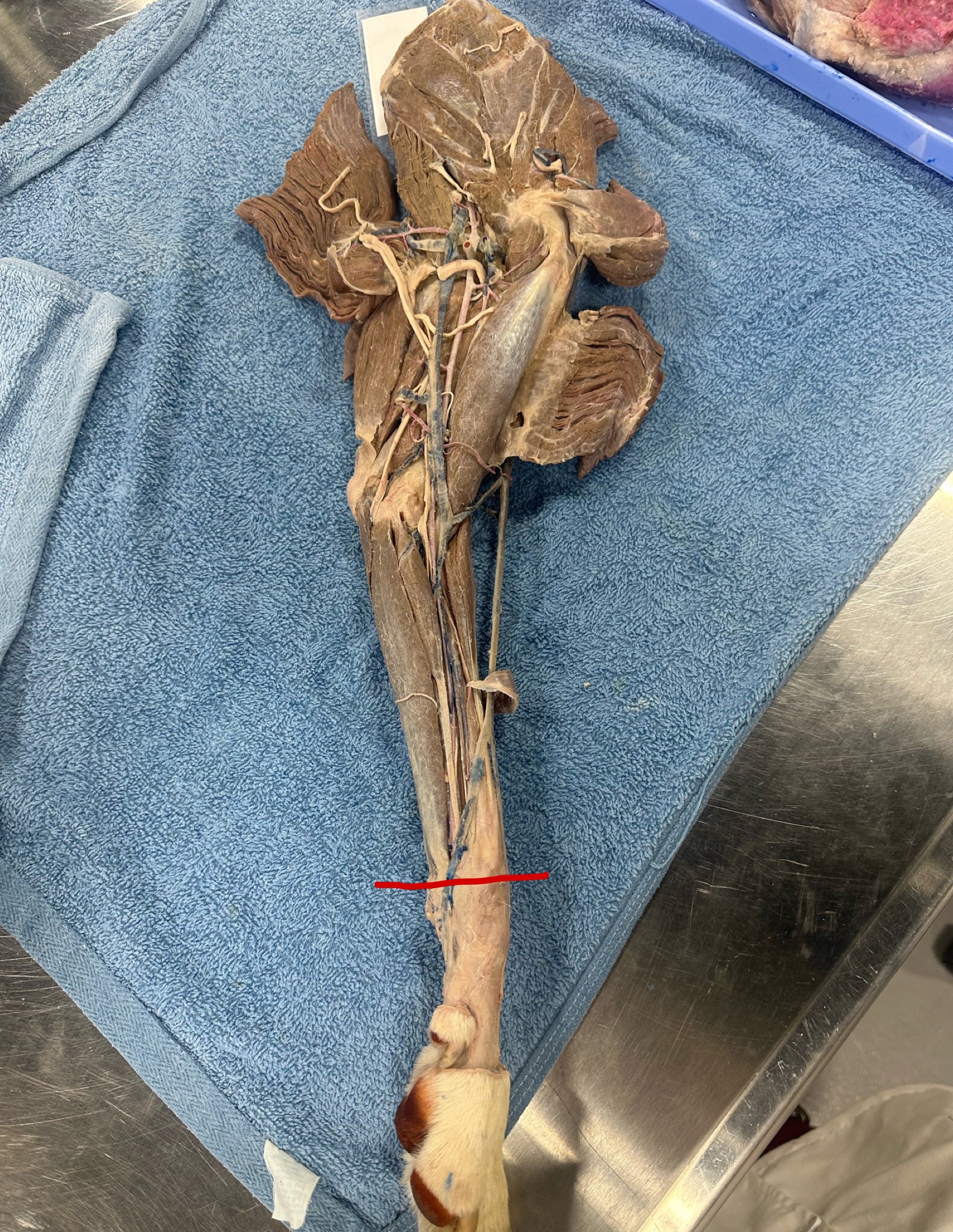 <p>When performing a dissection you accidentally cut the labeled vein</p><ul><li><p>what is this vein </p></li></ul><ul><li><p> where does this vein arise from</p></li></ul><p></p>
