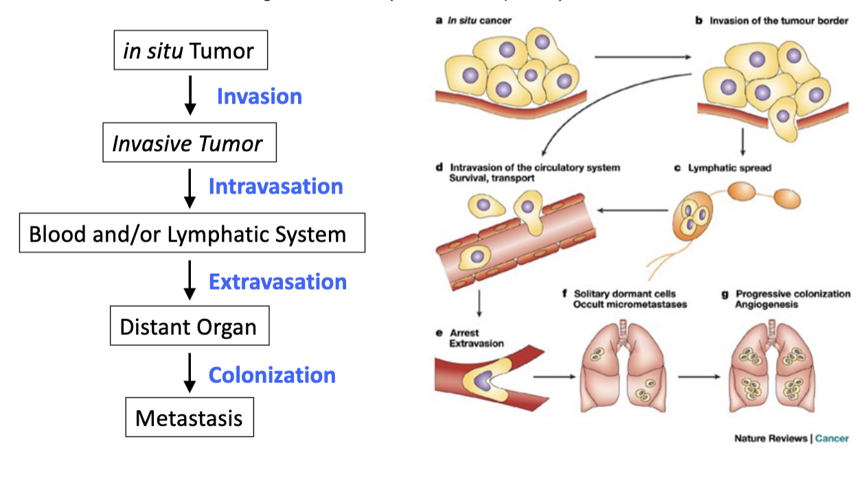 <p>tumor cells spread and grow in distant organs - metastasis </p><p>advanced stages of cancer </p><p></p>