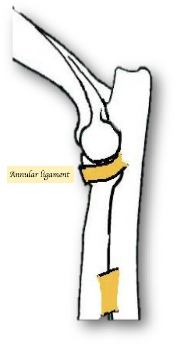 <p>Annular ligament. It runs from the lateral to medial coronoid process. </p>