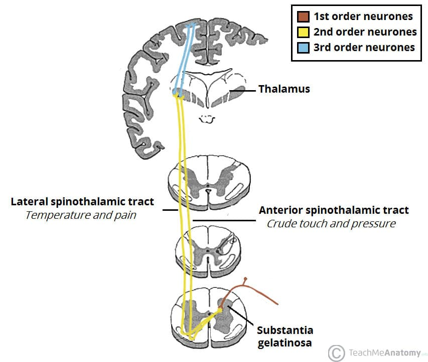 <p>Spinothalamic (anterolateral) tract, running in the brainstem before reaching the VPL thalamus. </p>