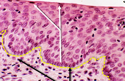 <p>what is this epithelial tissue </p>