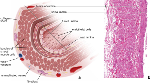 <p>what type of vein is this? thick tunica adventitia, inner, longitudinal smooth muscle bundles, outer, coarse network of collagen and elastin fibers</p>