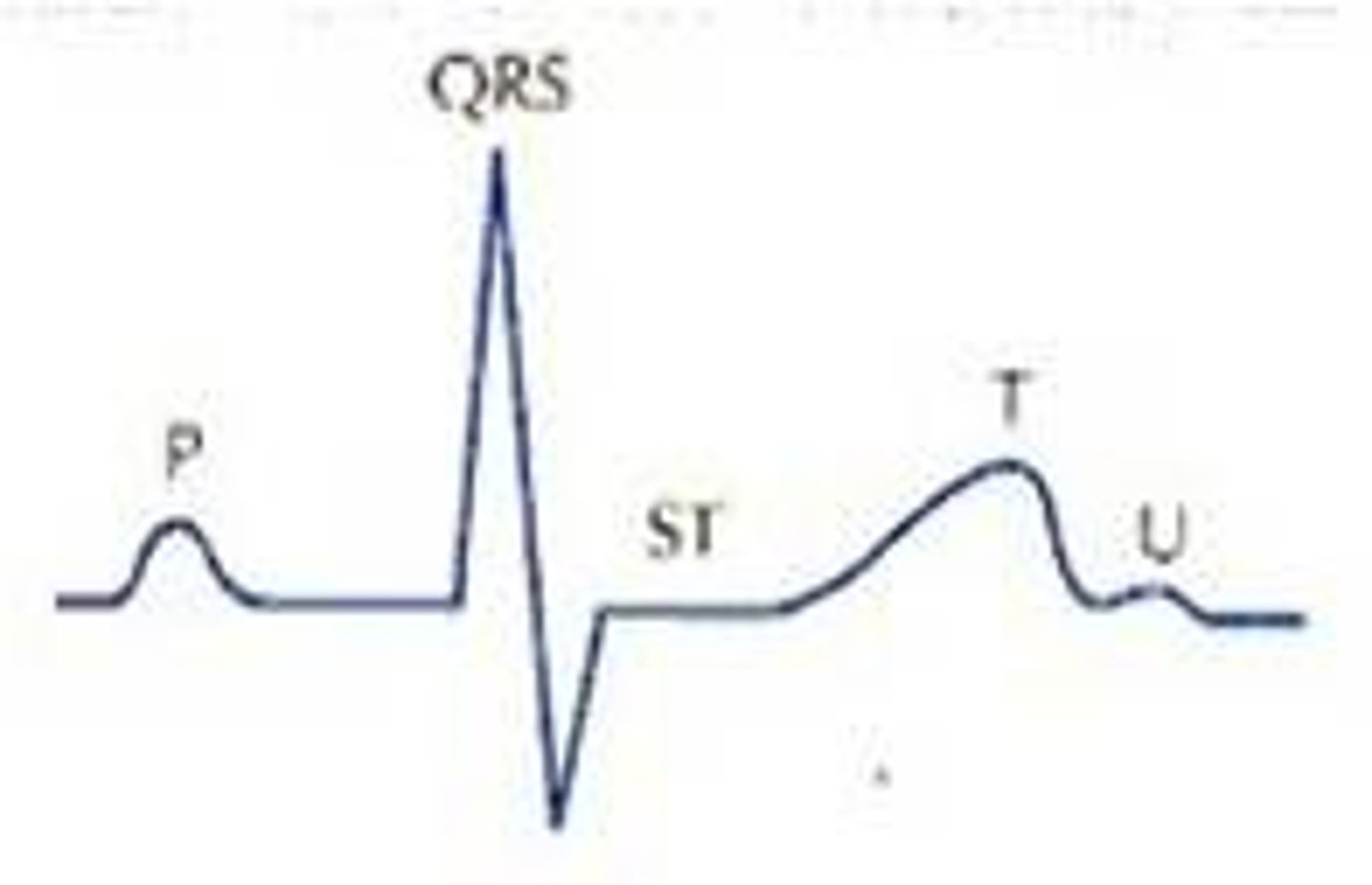 <p>What the U wave represent?</p>