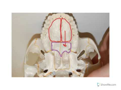 <p>Skull Landmark: Maxillary &amp; Palatine Bone Make….</p>