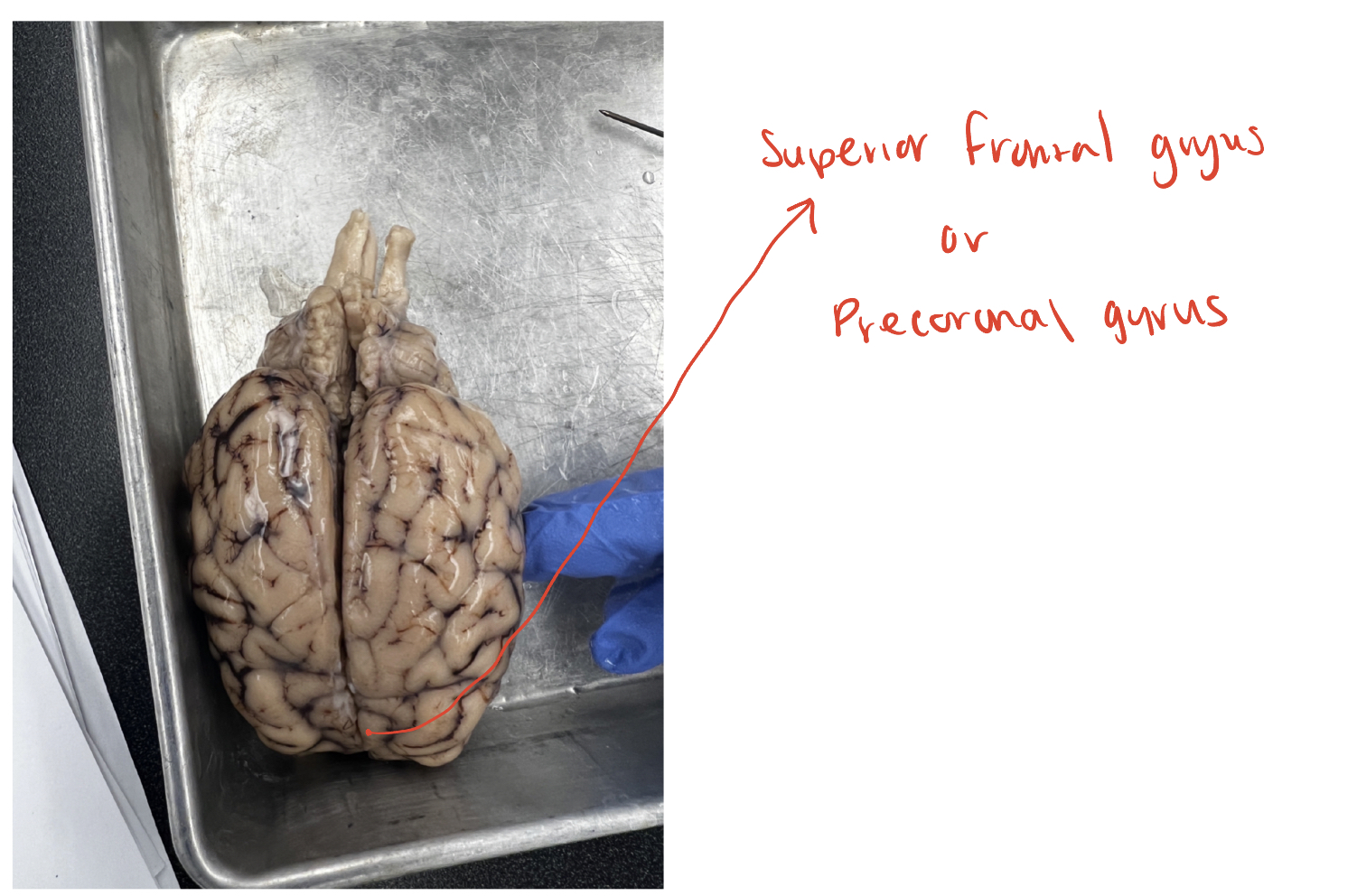 <p>(O) <span>Also known as the precoronal gyrus, this is the question mark shaped</span><br><span>gyrus in the frontal lobe that lies anterior to the cruciate/central sulcus.</span><br><span>This is the primary motor cortex for the sheep</span></p>