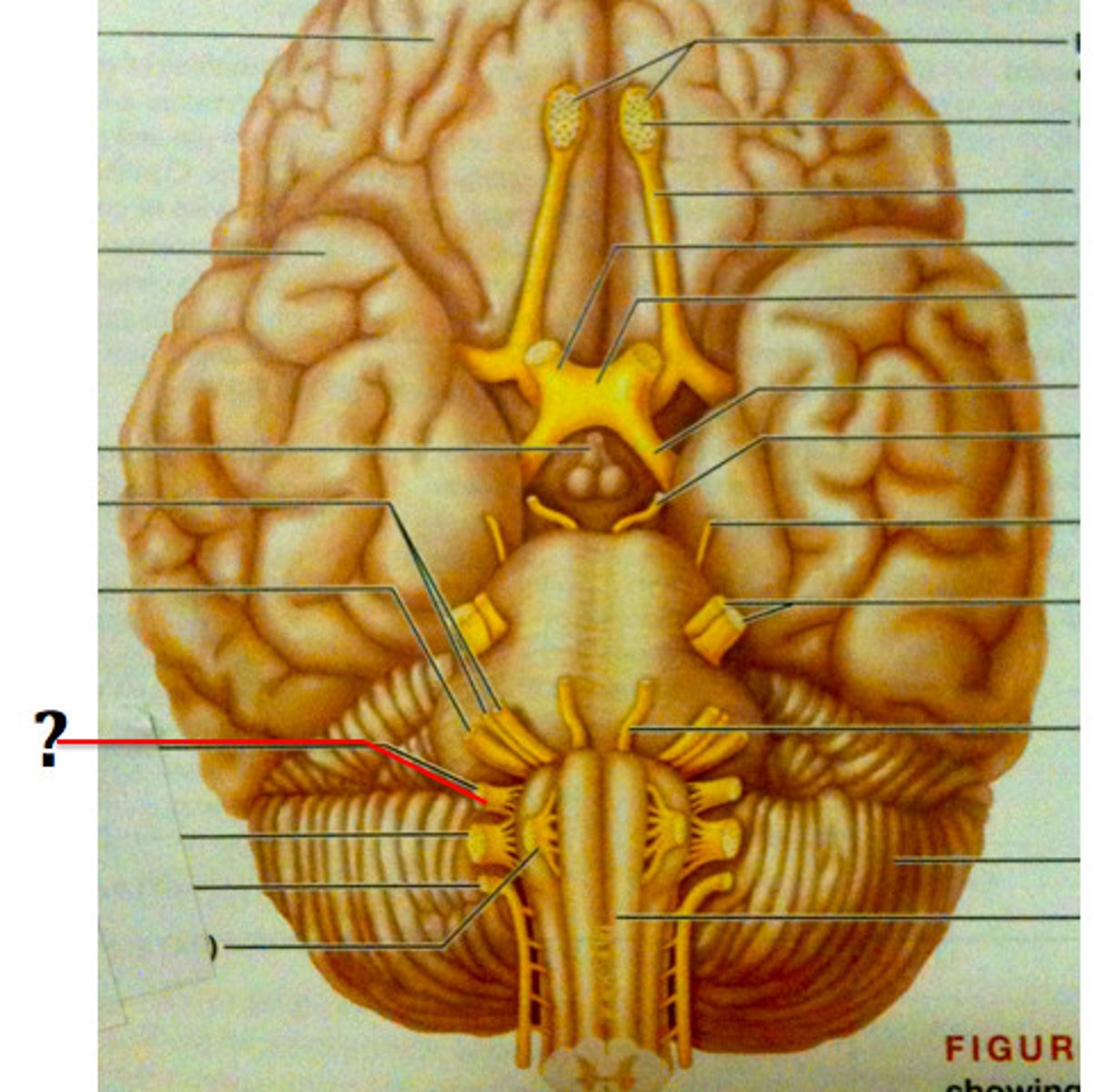 <p>-Fibers from medulla leave skull via jugular foramen and run to throat</p><p>-Motor functions - innervate part of tongue and pharynx for swallowing, and provide parasympathetic fibers to parotid salivary glands</p><p>-Sensory functions - fibers conduct taste and general sensory impulses from pharynx and posterior tongue, and impulses from carotid chemoreceptors and baroreceptors</p>