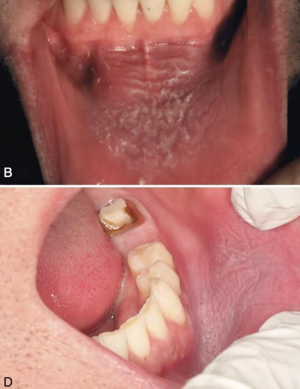 <p>which environmental/reactive lesion:</p>