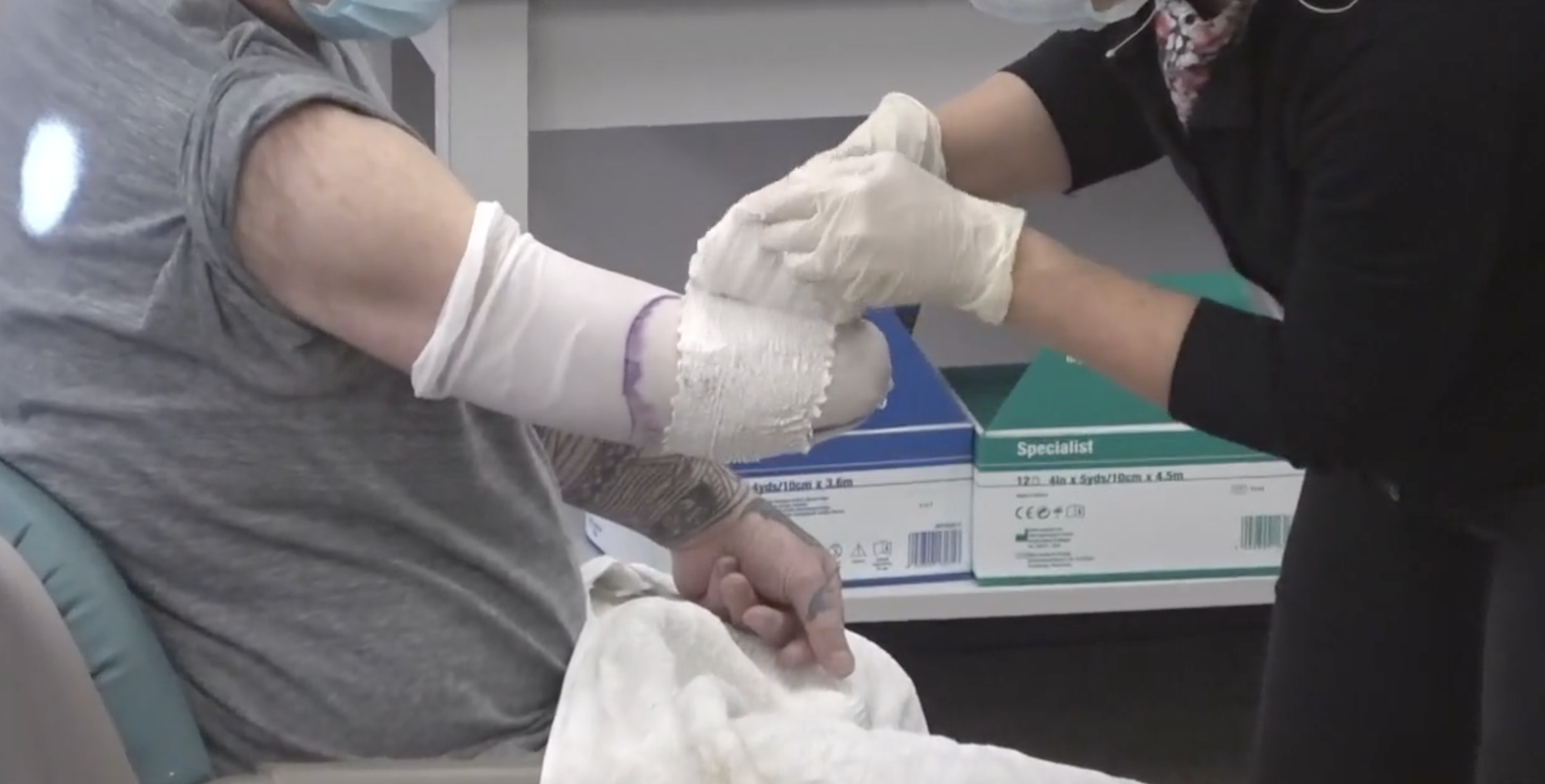 <p>proximal to cubital fold/olecranon to avoid the cast slipping off</p>