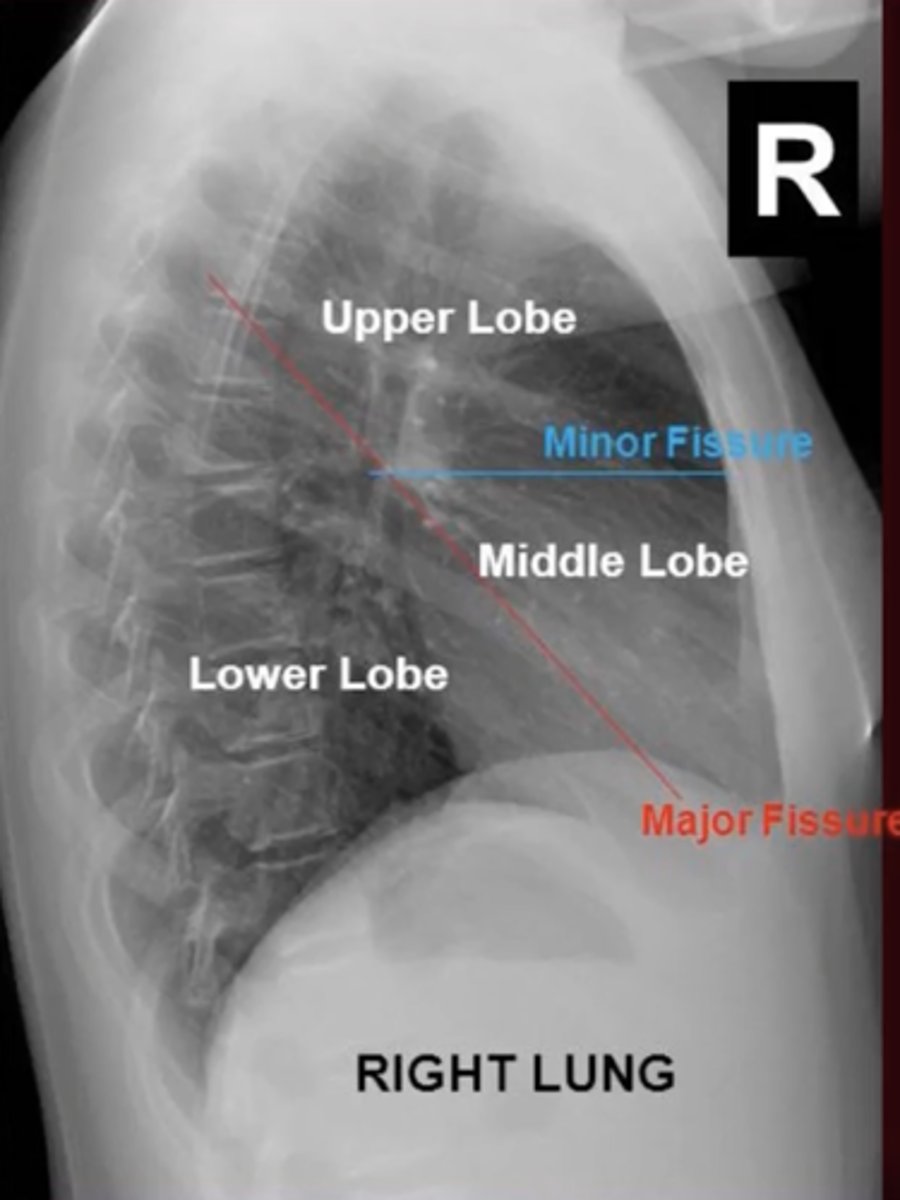 <p>What fissure separates the RUL from RLL and the RML from RLL?</p>