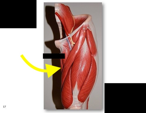 <p>What muscle is this?*****</p>