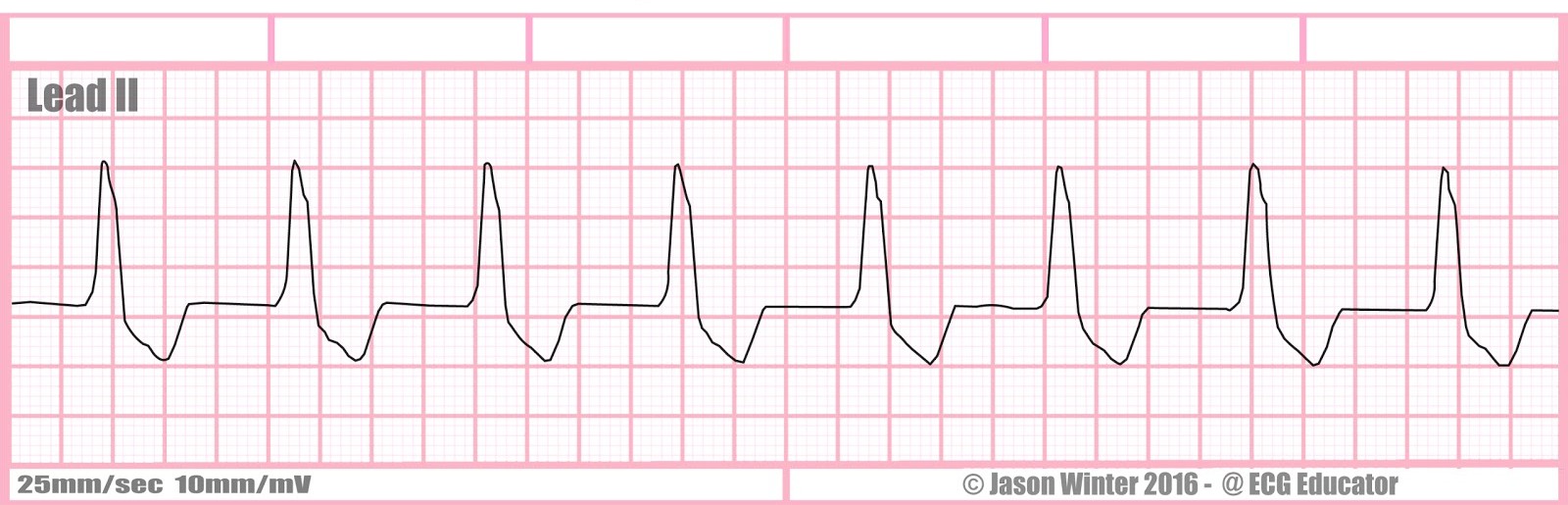 <p>Rate + characteristics?</p>