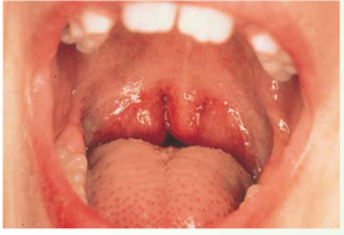 <p>peds</p>