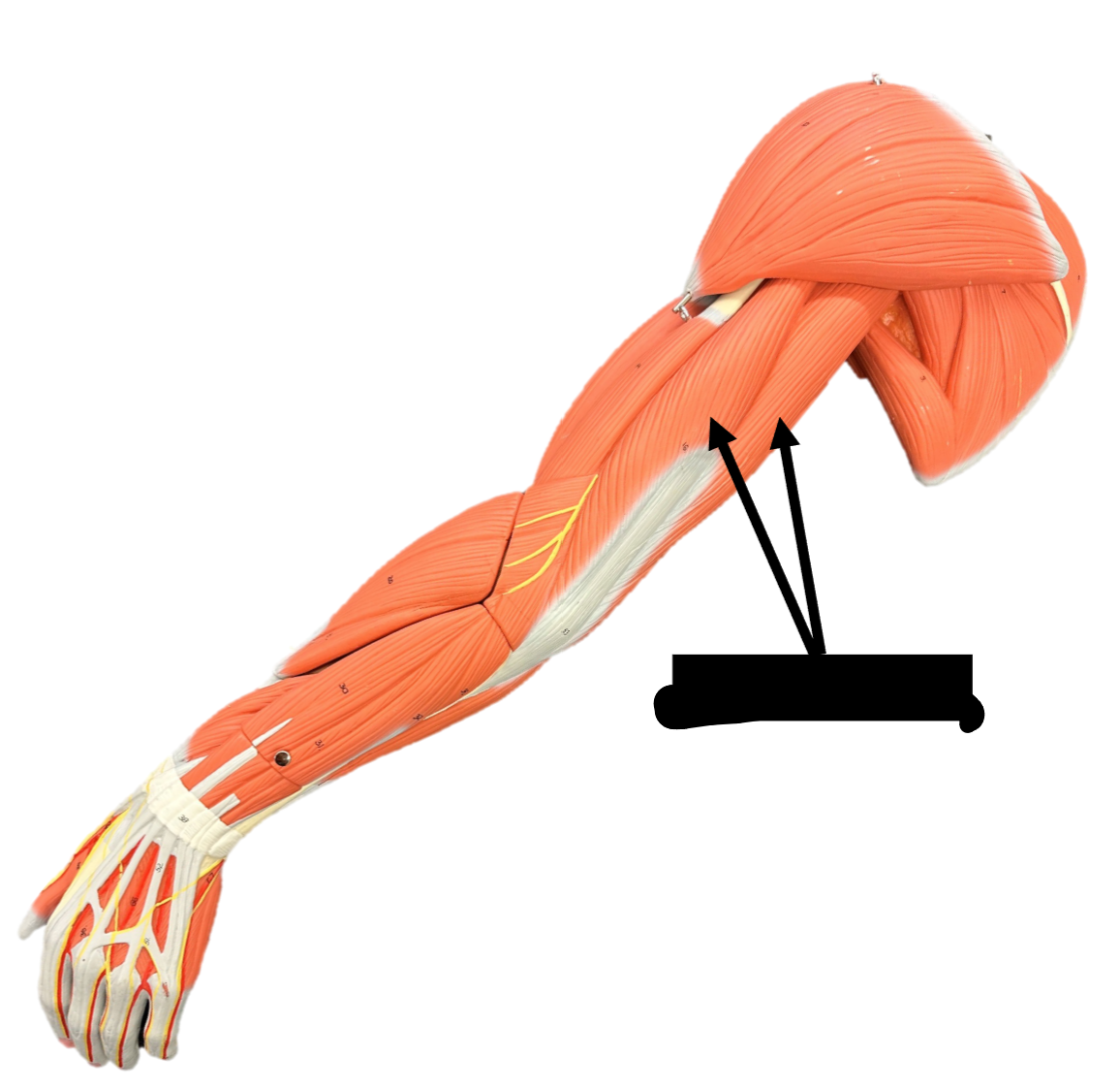 <p>Origin: lateral + medial surfaces of the humerus</p><p>Insertion: Olecranon process of ulna</p><p>Function: extends elbow </p>