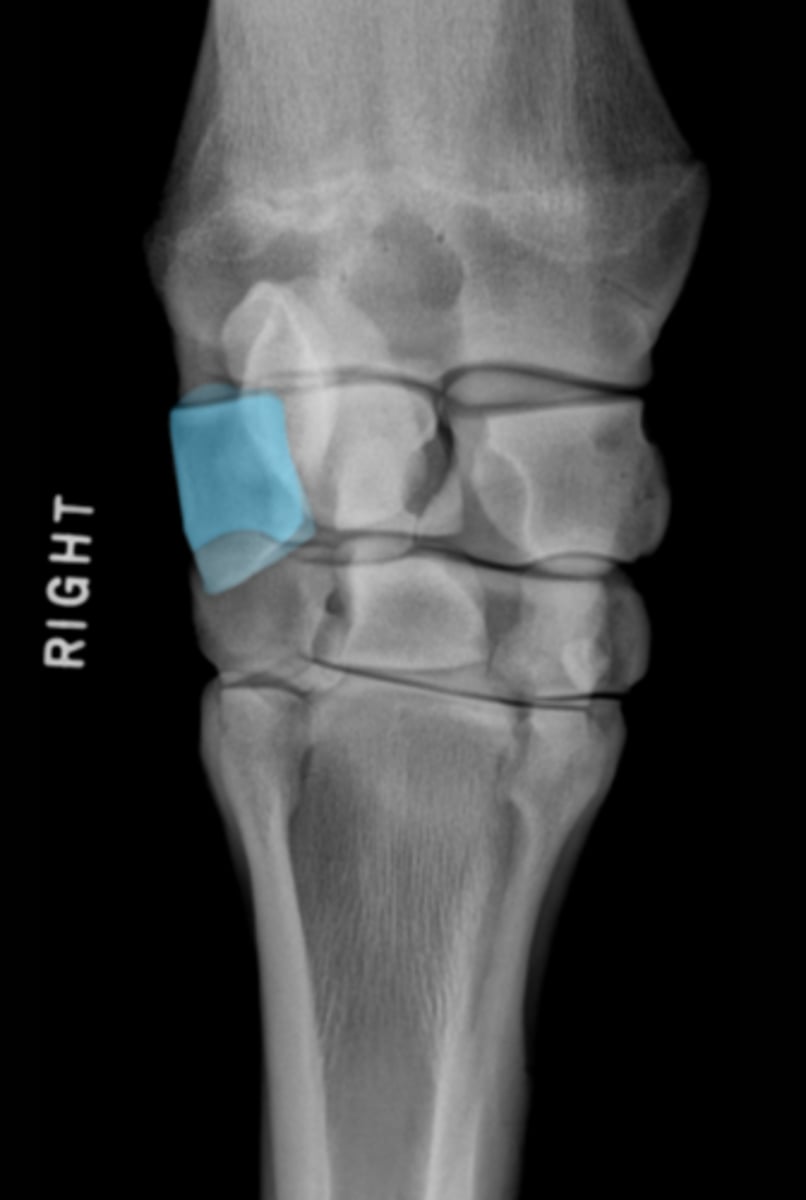 <p>What bone is highlighted?</p>