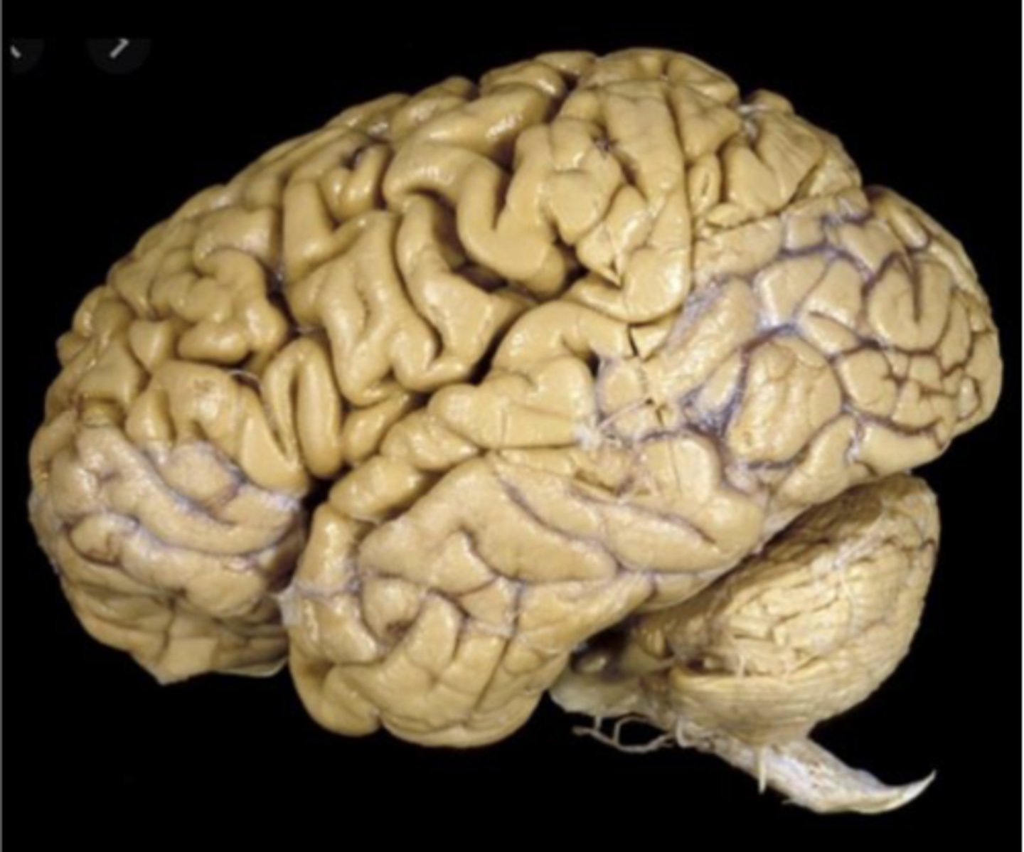 <p>the brain can be divided into what 3 sections?</p>