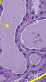 <p>Image of Breast when activated</p>