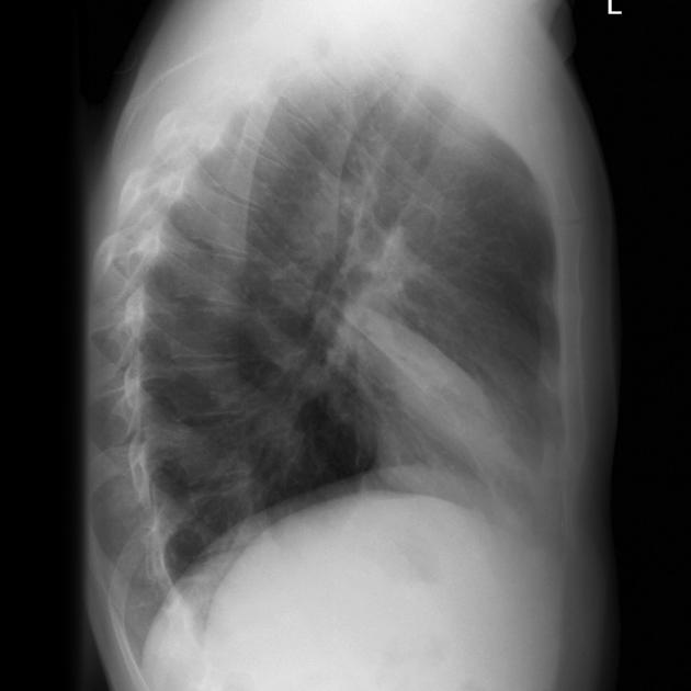 <p>Describe the abnormality demonstrated.</p>