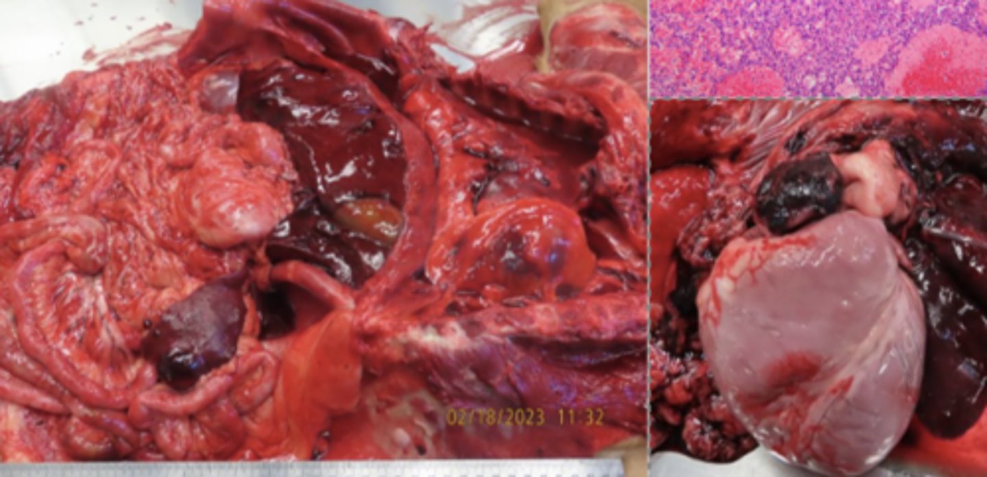 <p>What kind of tumor is this?</p>