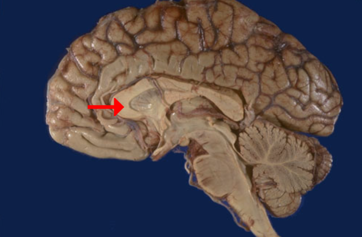 <p>Label this brain part</p>