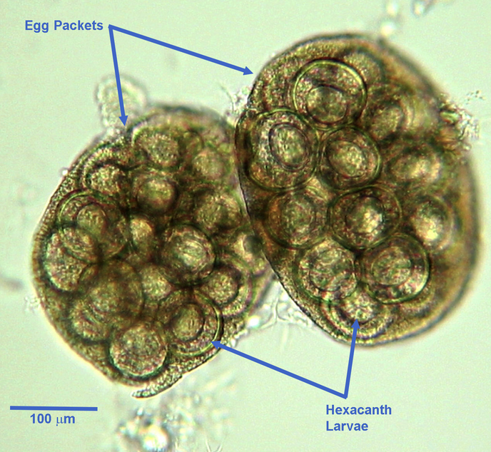 <p>What parasite egg is this?</p>