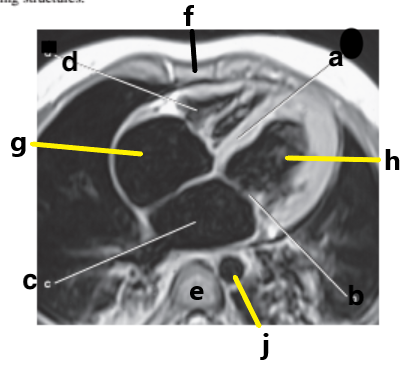 <p>What is letter f ?</p>