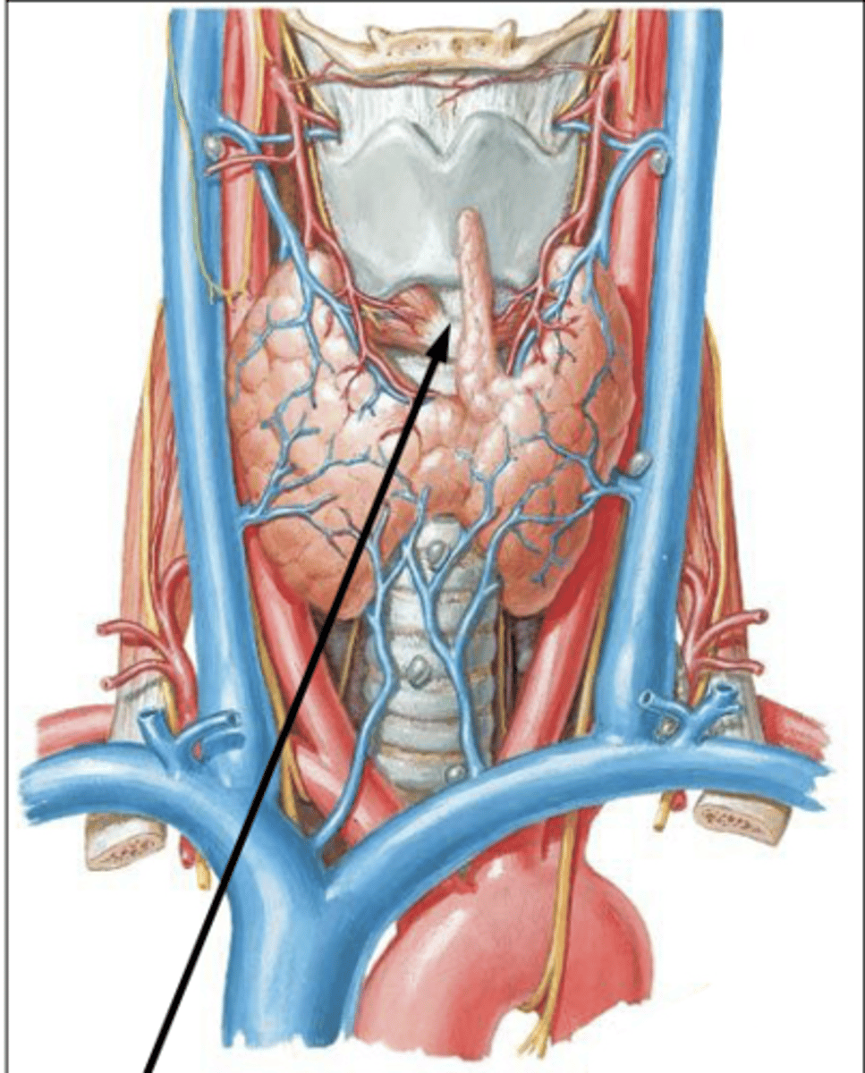 <p>What is the arrow pointing to?</p>