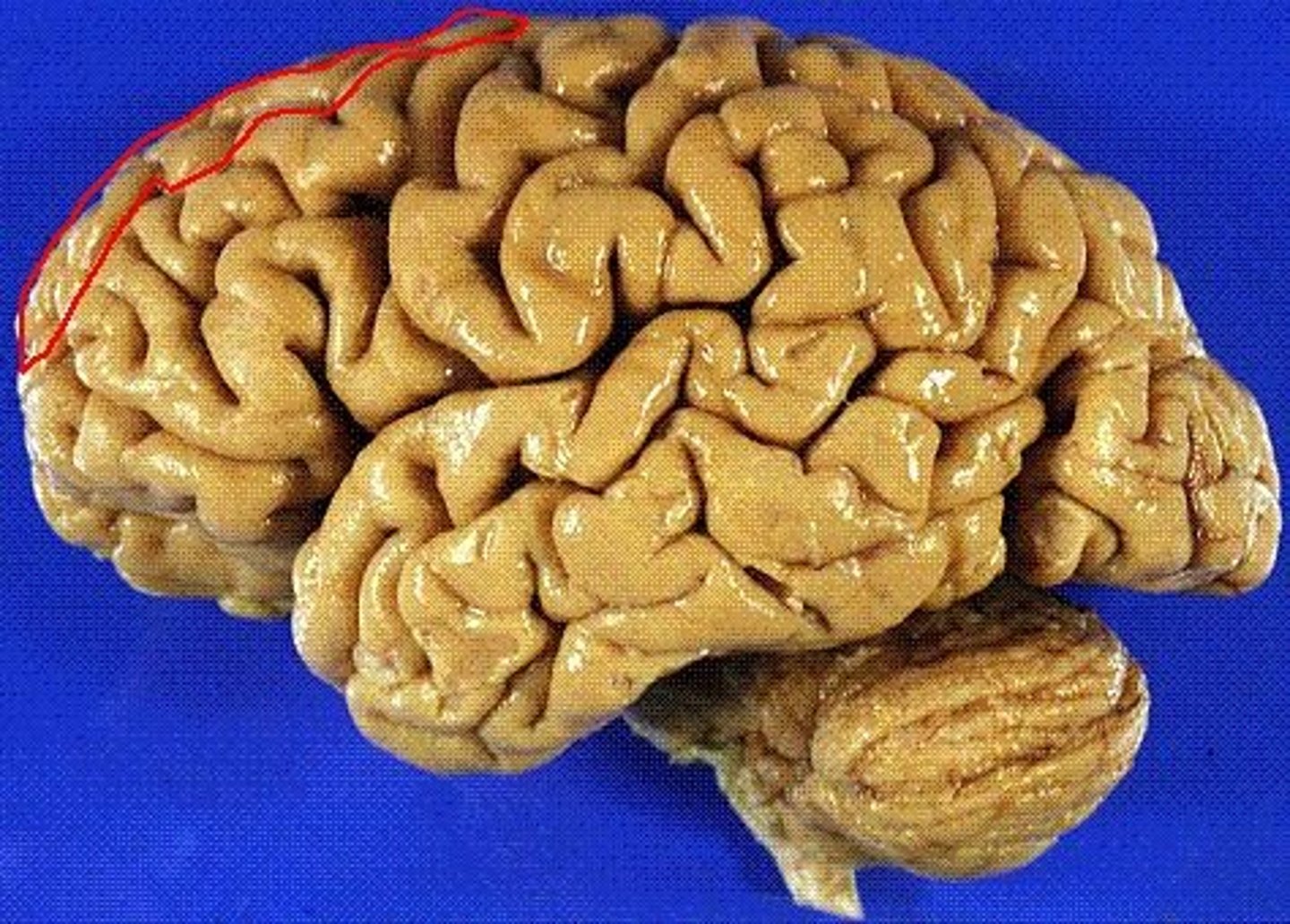 <p>the frontal lobe gyrus that runs horizontally along the top of the lobe</p>