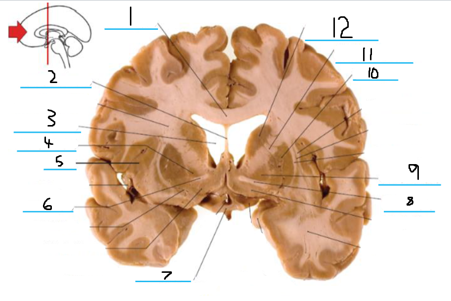 <p>#6 and #8 is the:</p>
