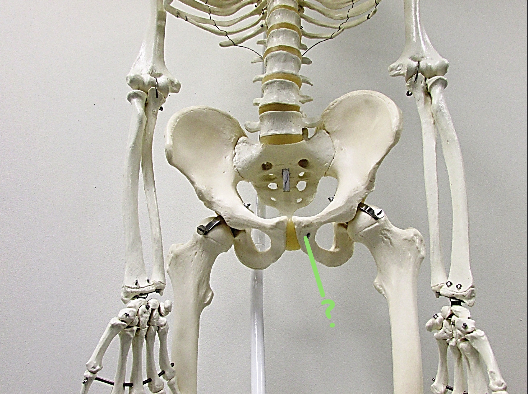 <p>Determine the part of the Coxa/Sacrum highlighted</p>