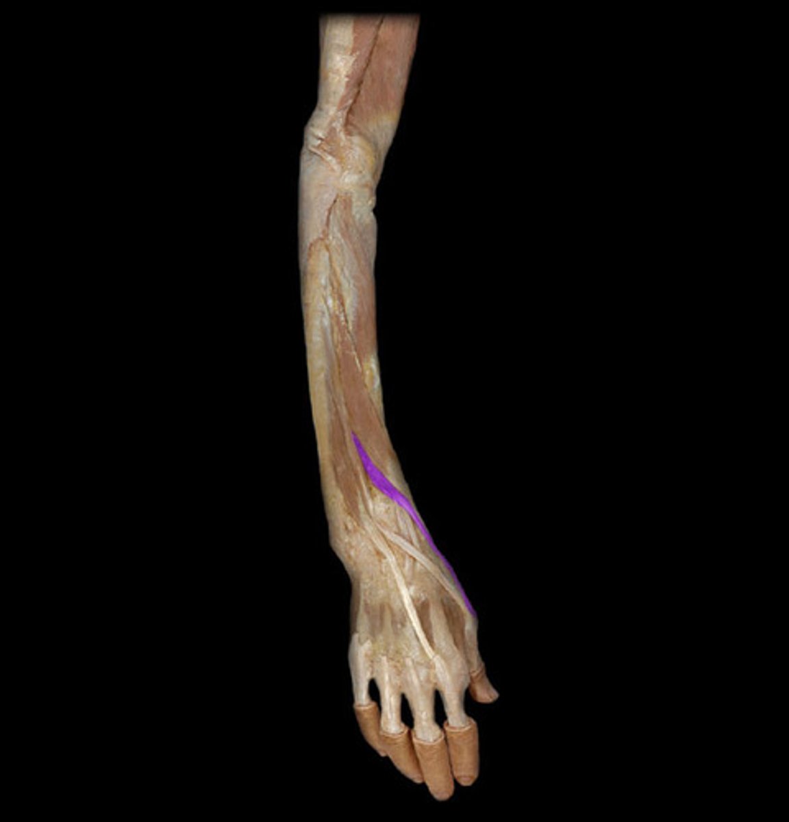 <p>O: Posterior surface of shaft of radius</p><p>I: Base of proximal phalanx of thumb</p><p>N: Deep branch of radial nerve</p><p>A: Extension of Thumb MCP Jt.</p>