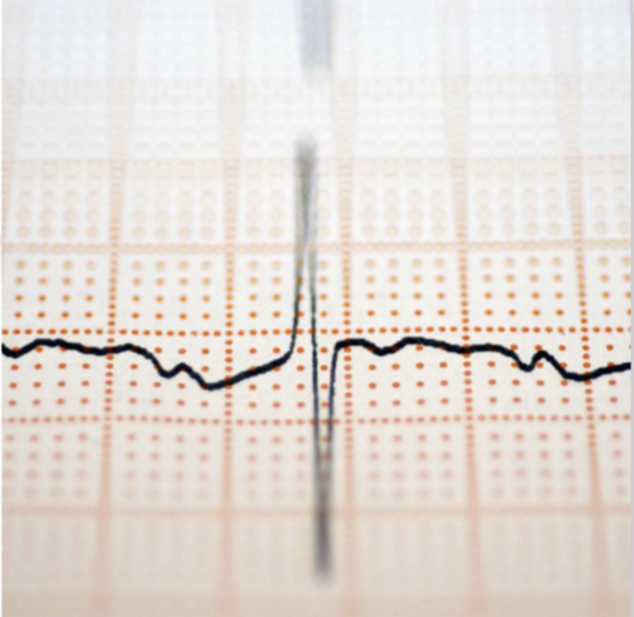 <p>- A graph of the hearts electrical impulses and patterns as measured by electrodes</p><p>- versatile, immediate</p>