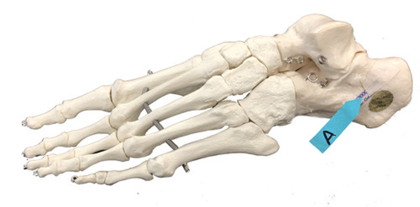 <p>Identify this specific bone.</p>