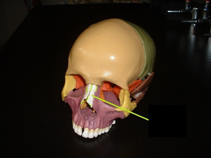 <p>two bones that make up the top portion of your nose that do not connect in the middle. (bridge of your nose)</p>