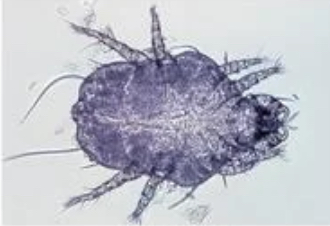 <p>Name this mite</p>