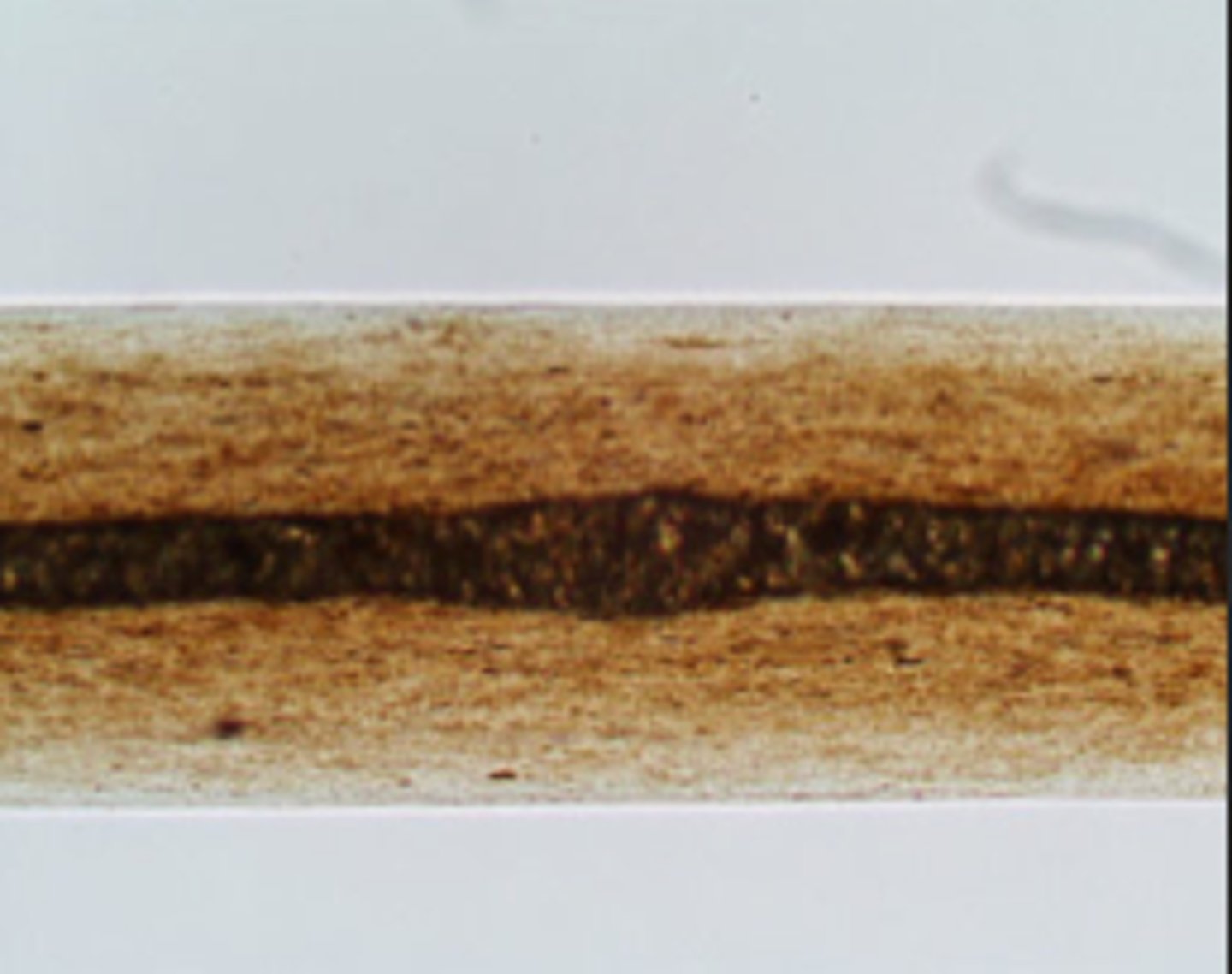 <p>Measures the width of the medulla relative to the width of the hair</p>