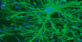 <p>What neurons are pictured?</p>