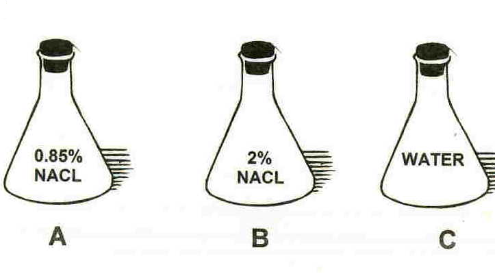 <p>What happens to a red blood cells if place in solution A?</p>