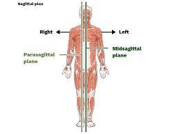 vertical plane that divides body into right and left, can be equal (midsagittal) or unequal (parasagittal) 