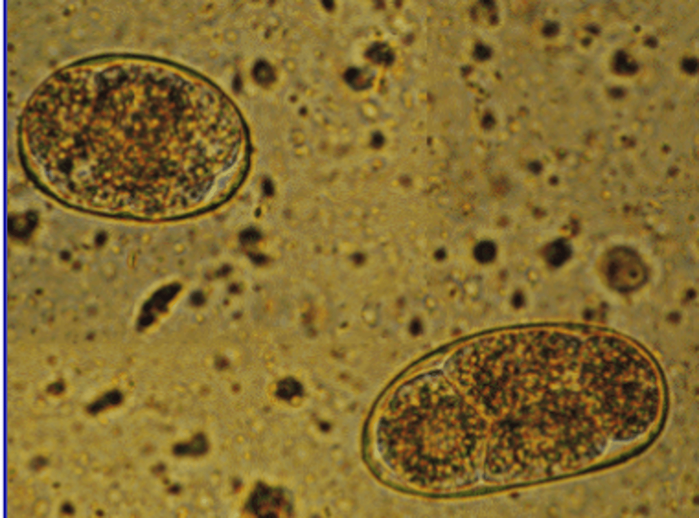 <p>this egg containing 8 blastomeres is from what species?</p>