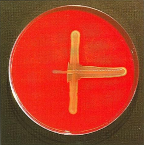 <ol><li><p>Test</p></li><li><p>Horizontal streak</p></li><li><p>Vertical streak </p></li><li><p>Is there a presence of <strong>enhanced haemolytic effect</strong>?</p></li></ol><p></p>