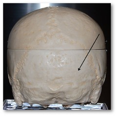 Name this bone.