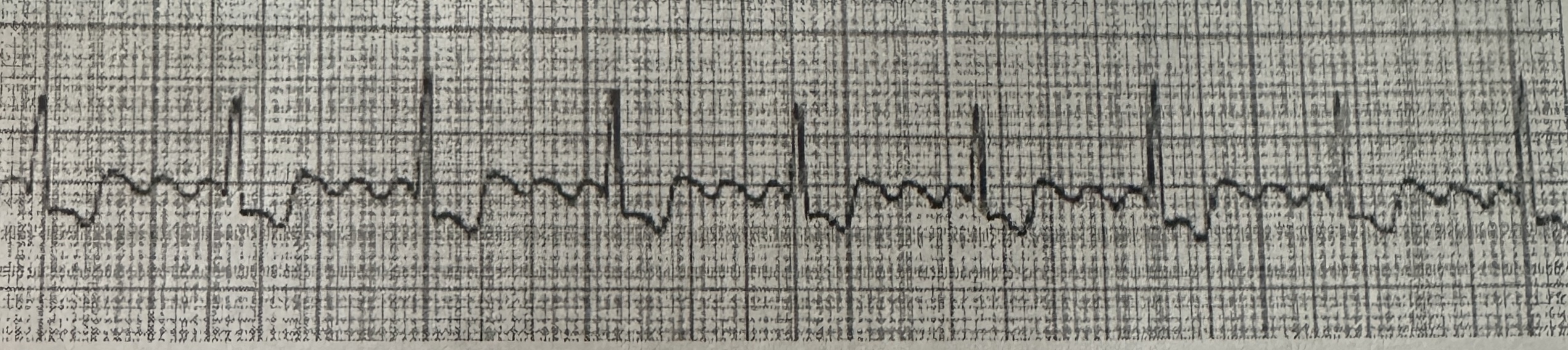 <p>identify the following rhythm (Lead II)</p>
