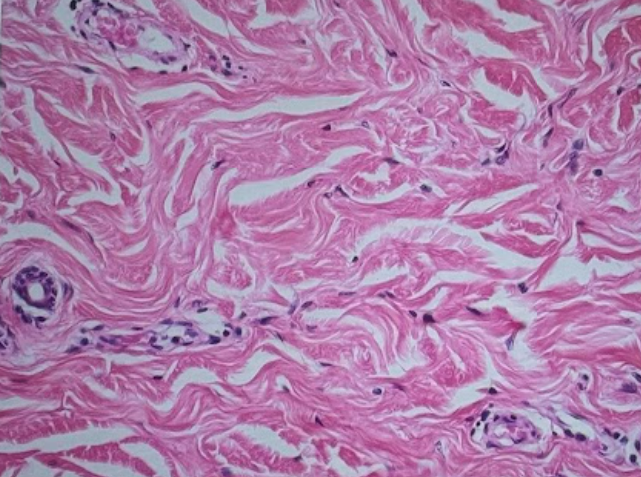 <p>Nerve Cells</p>