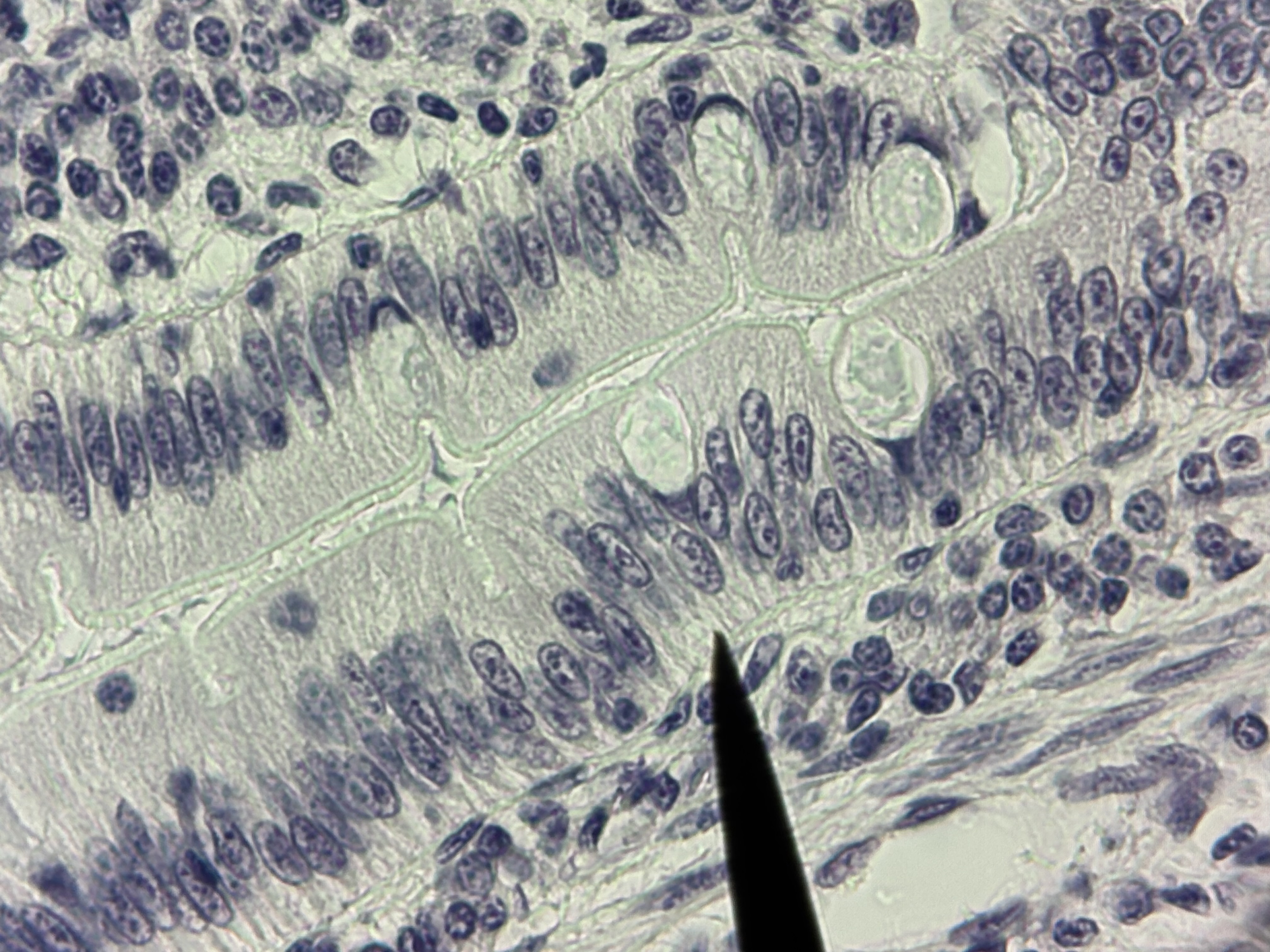 <p><span>Simple Columnar ET with goblet cells and microvilli</span></p>