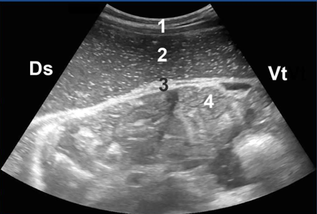 <p>What type of ulcer is this?</p>