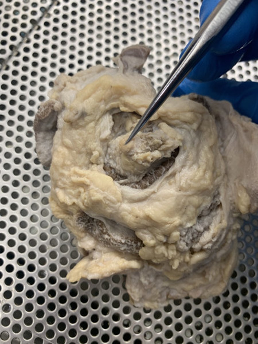 <p>the nerve that carries neural impulses from the eye to the brain</p>