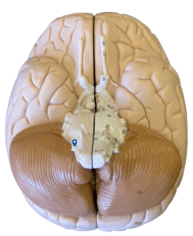 <p>What cranial nerve is the arrow pointing to?</p>